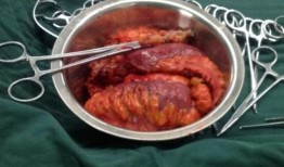 息肉切后可以吃凉瓜吗,凉瓜食用指南