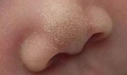 吃小白瓜嘴上起泡,甜蜜解暑却需小心口腔不适