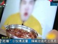 肛肠不好可以吃瓜吗,揭秘瓜类食物对肛肠健康的影响